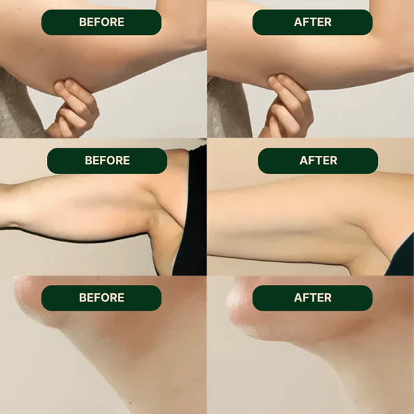 Lymphatic Drainage Support